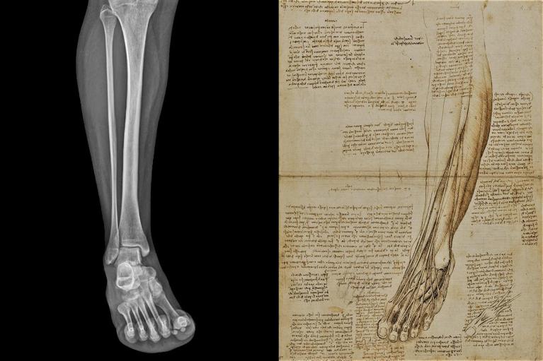 Leonardo Da Vinci, I muscoli e i tendini della parte inferiore della gamba e del piede, gessetto nero, penna e inchiostro acquarellato, 1510-11 circa. Windsor Castle, Royal Library, RCIN 919017r / Radiografia dell’arto inferiore.