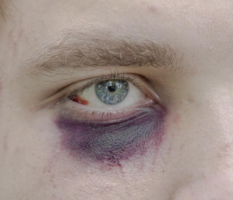 ©Jędrzej Nowicki_World Report Award_FFE21. Alexander, uno dei manifestanti arrestati, posa per un ritratto davanti al centro di detenzione di Okrestina Street a Minsk, in Bielorussia. Alexander stava andando a casa di un amico quando è stato catturato dai militari durante la prima notte delle proteste, il 10 agosto 2020. Ha trascorso 4 giorni in custodia cautelare. È stato picchiato più volte. Alexander studia al Politecnico di Minsk.