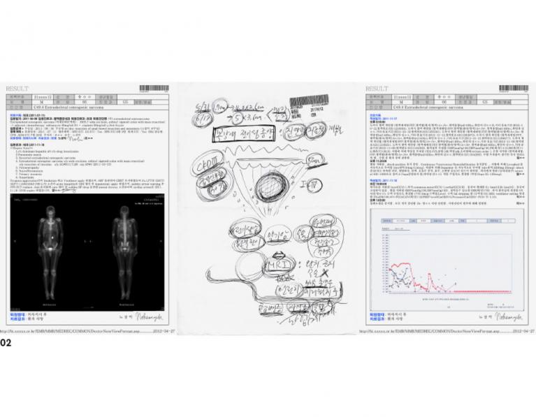 Jason Sangik Noh, Sig. Yoo, anni 56, Donam-Dong, C49.4 Sarcoma osteogenico extrascheletrico, 2012. Courtesy of the VHS-MC Board of Ethics