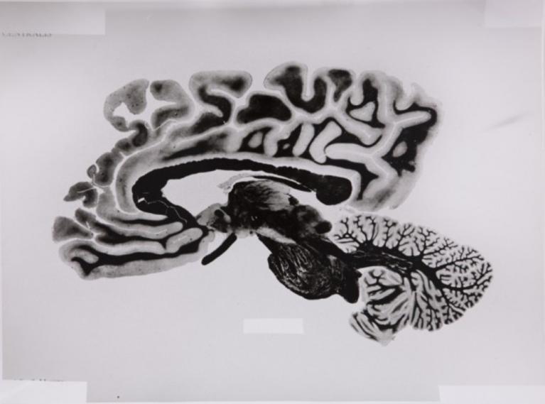 Rossella Biscotti, 168 Sections of a Human Brain, 2009-14. Series of 108 silver gelatin prints on baryth paper, 30 x 40 cm each. Courtesy of the artist
