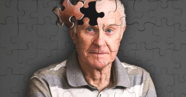 alzheimer.jpg